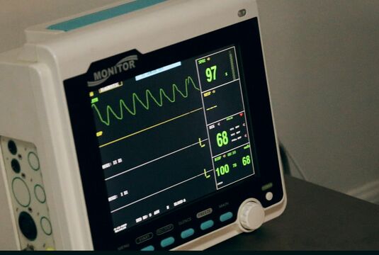 electrocardiogramme