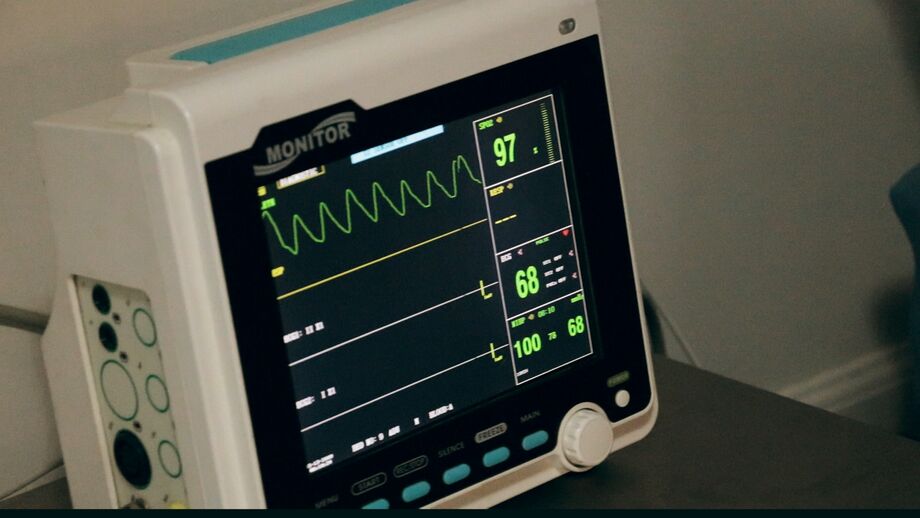 electrocardiogramme